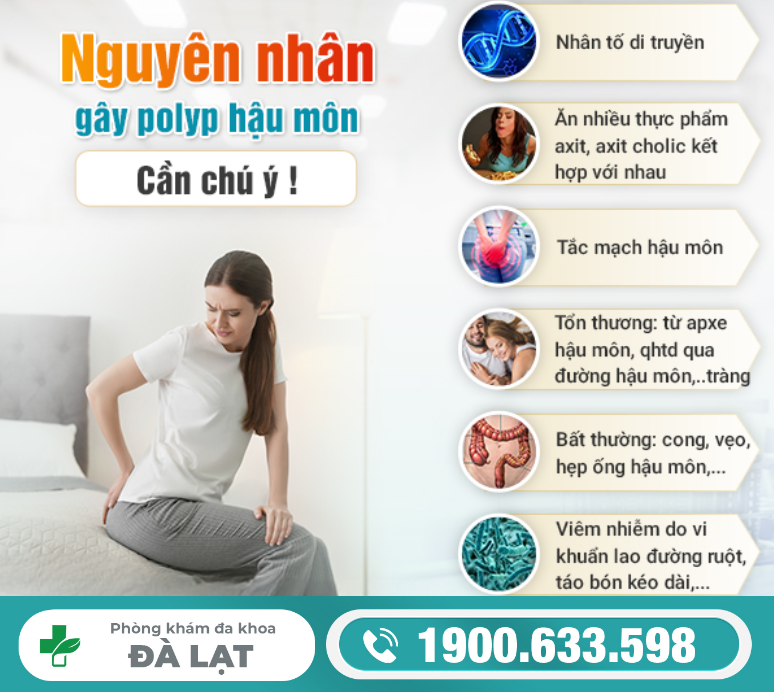 Hình ảnh minh họa